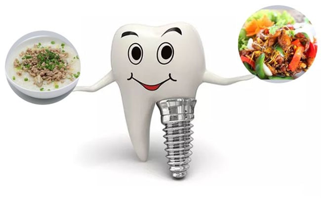 Trong rang implant bao lau thi an duoc