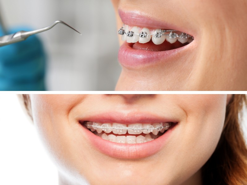 chinh nha va nieng rang